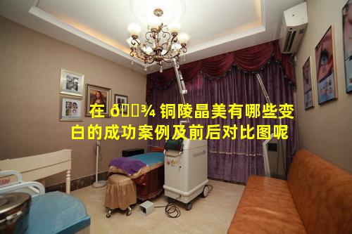 在 🌾 铜陵晶美有哪些变白的成功案例及前后对比图呢